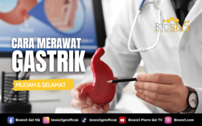 Cara Merawat Gastrik – Mudah & Selamat