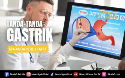 Tanda-Tanda Gastrik – Apa Anda Perlu Tahu