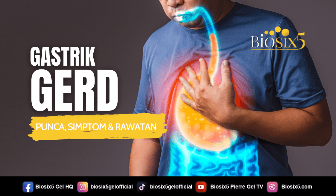 Gastrik Gerd – Punca, Simptom & Rawatan