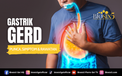 Gastrik Gerd – Punca, Simptom & Rawatan