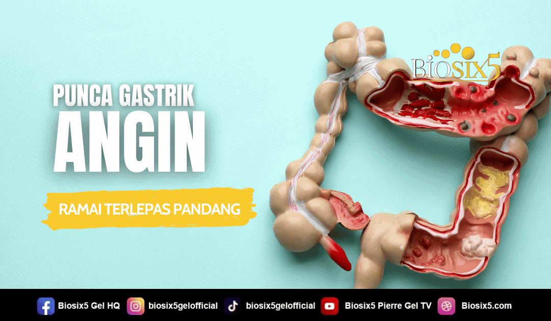 Punca Gastrik Angin